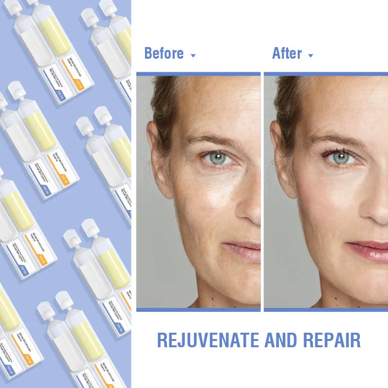 OEM Customized Hot Sale Retinol Peptides Vitamin E & C Anti-Aging Face Serum, Toner & Ampoules for Fine Lines & Wrinkles Removal